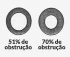 Grau II – De 51% a 70% de obstrução.